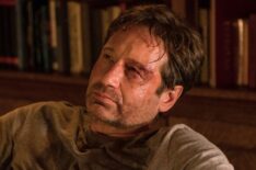 David Duchovny bruised up