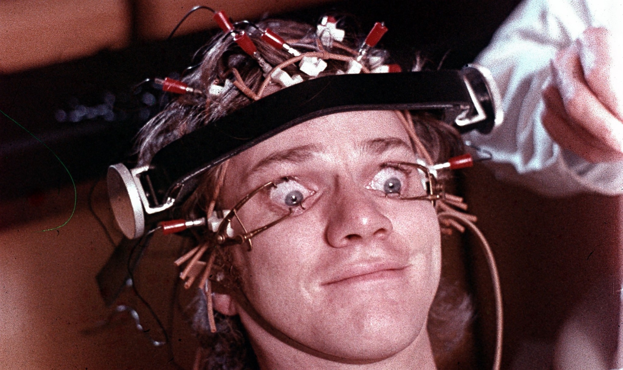 Malcolm McDowell in A Clockwork Orange