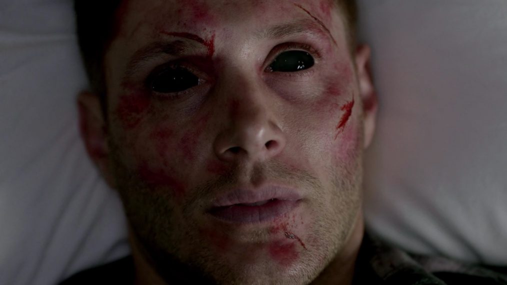 Supernatural 923 Dean