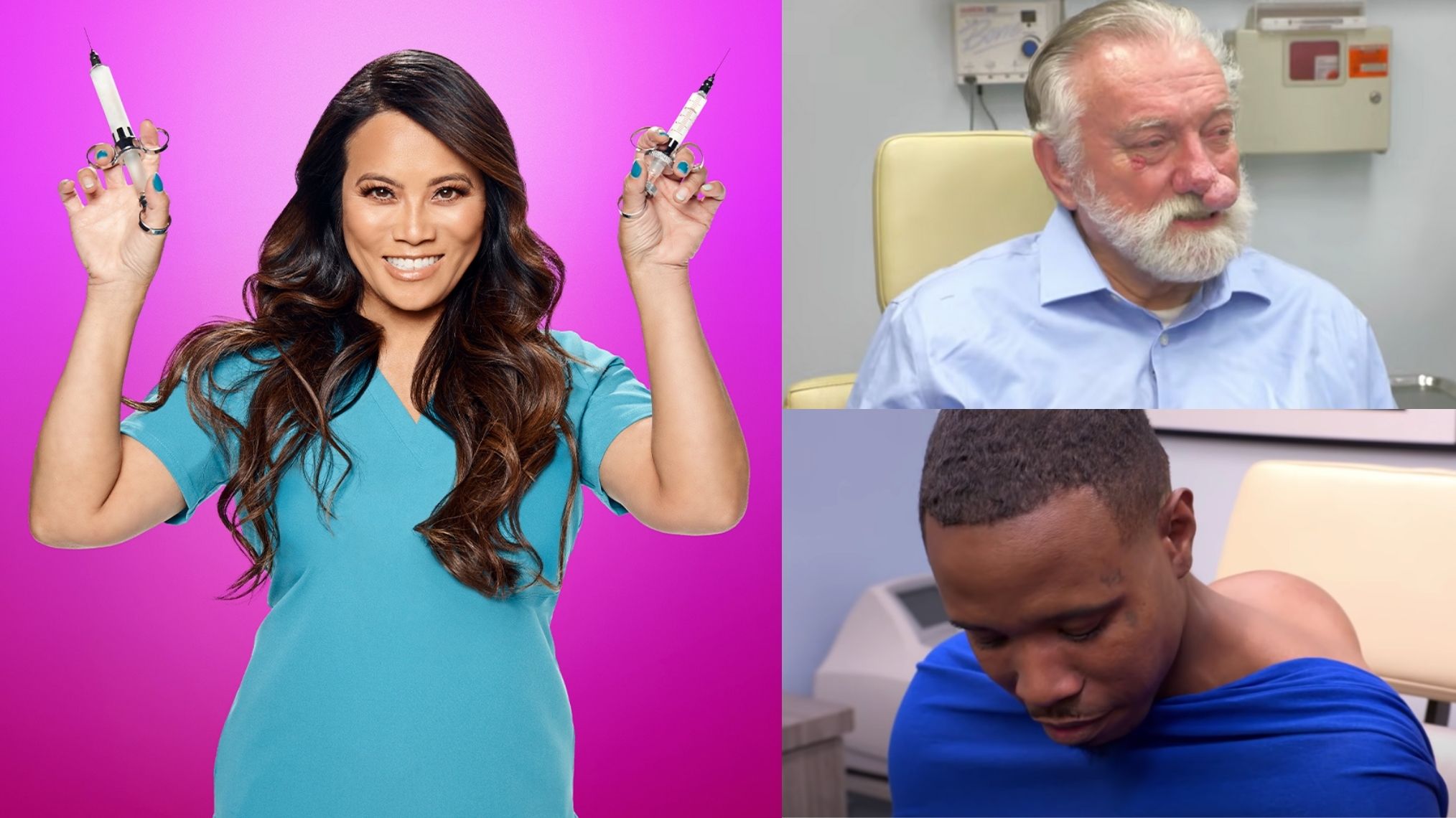 The 10 Most Unforgettable Pimple Popper' Cases (VIDEO)