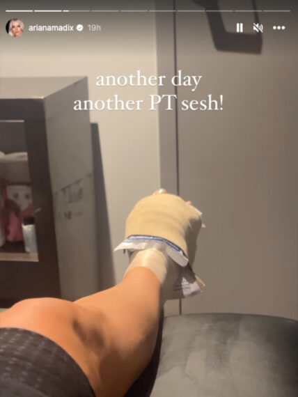 Ariana Madix foot injury