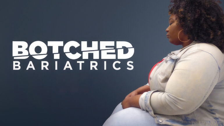 Botched Bariatrics - TLC