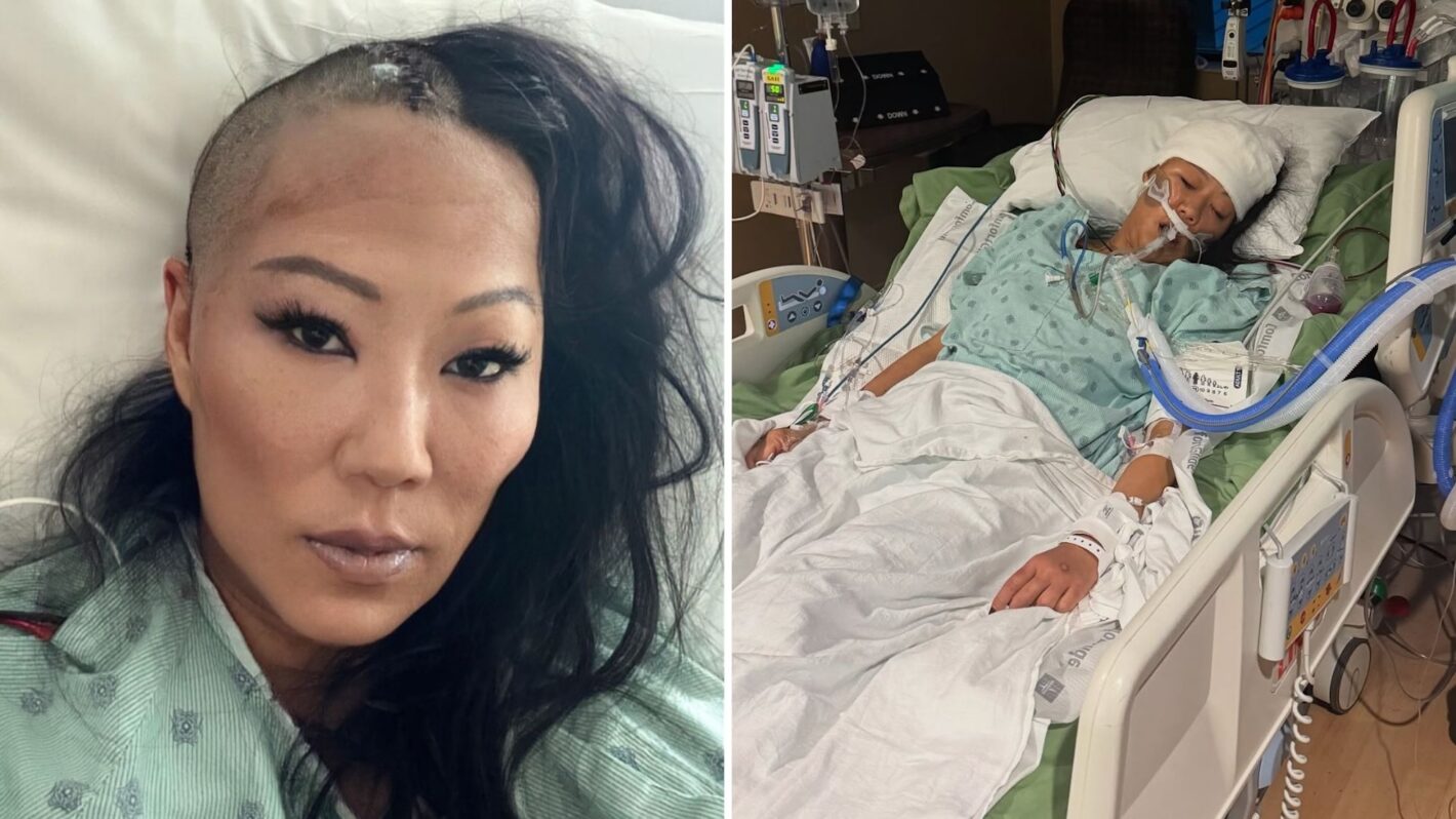 'Bling Empire' Star Lynn Ban Undergoes Emergency Brain Surgery After