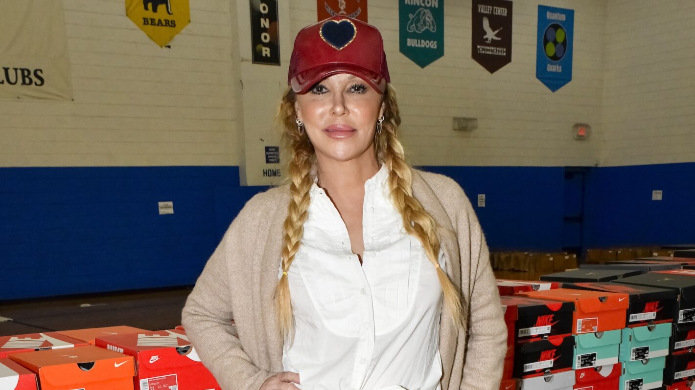 'RHOBH's Brandi Glanville Terrifies Fans With Burned Face After At-Home Chemical Peel