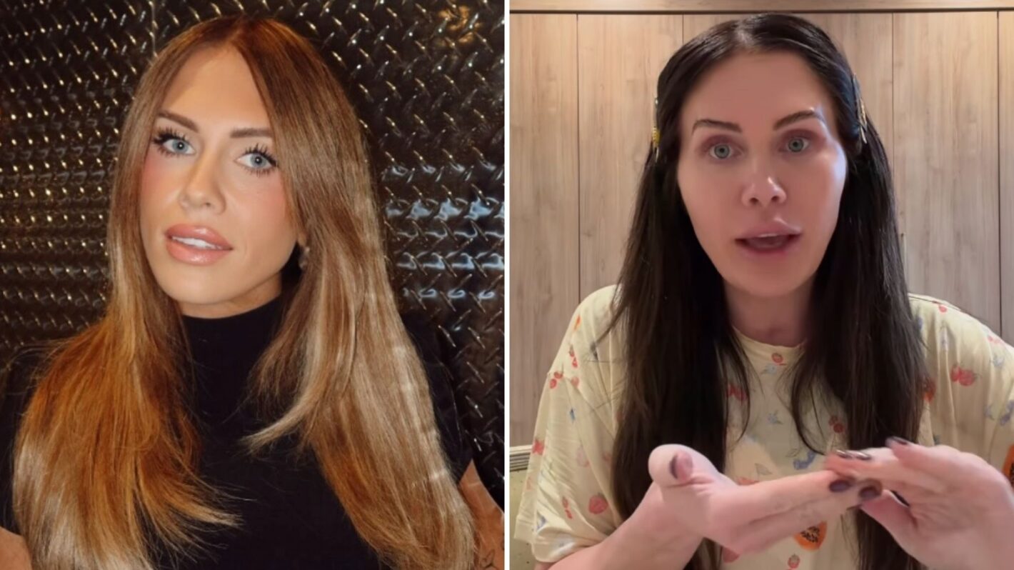 Jessi Ngatikaura before and after