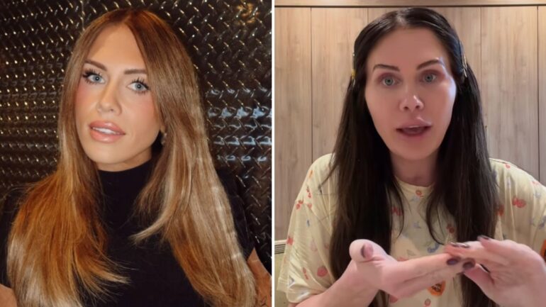 Jessi Ngatikaura before and after