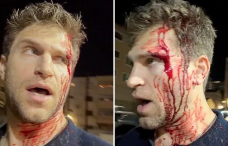 Keegan Allen