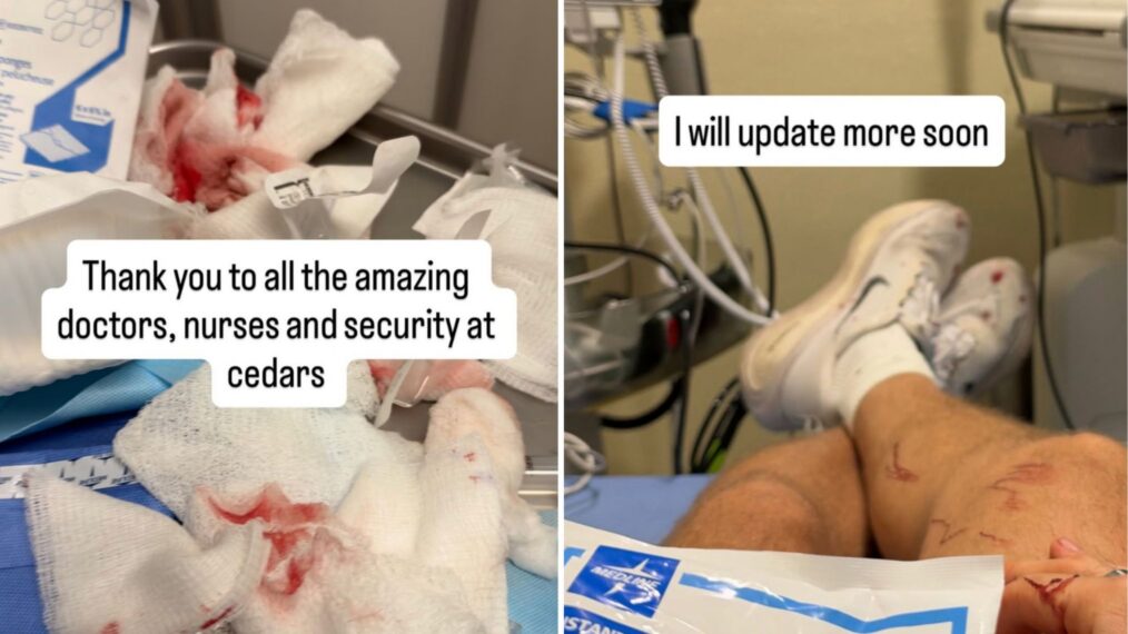 Keegan Allen recovery photos from his Instagram Stories updates
