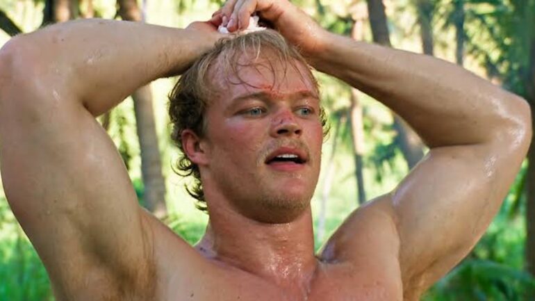 ‘Survivor 51’s Brady Booker Details Gruesome Thumb Accident & Gives Update